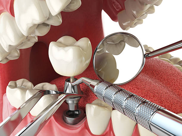 Best Emergency Dentist for Special Needs Patients in Cordaville, MA